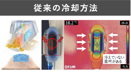 最大-15℃施術時間 最短20分効果の高い360°冷却!